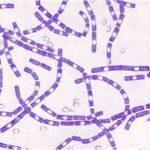 Bacillus Anthracis