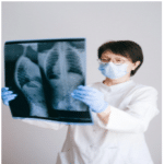 A doctor looking at a X-ray sheet, Examination of asthma affected lungs, Asthma affected woman.