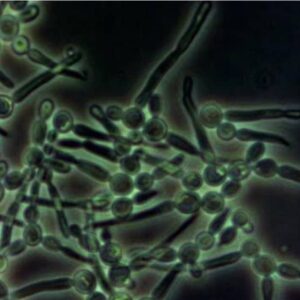 Candida Albicans microscopic view