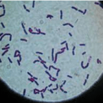 Bacillus cereus