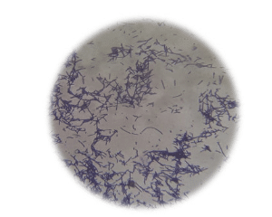 Microscopic observation of Gram’s stained Lactobacillus spp