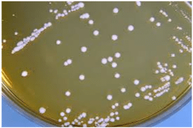 Lactobacillus brevis