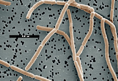 Lactobacillus delbrueckii. subspecies bulgaricus. Lactobacillus delbrueckii