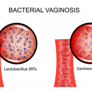 Lactobacillus iners;