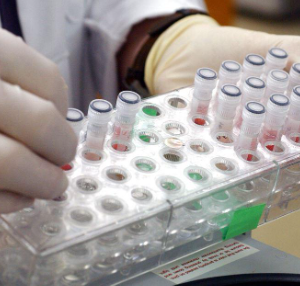  Blood test samples for monkeypox